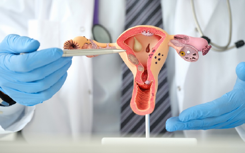ginekolog pokazuje sztuczny model żeńskich narządów